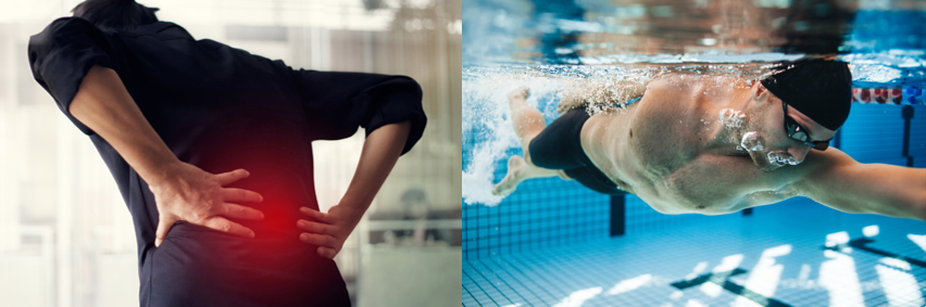 La natation pour soulager la sciatique