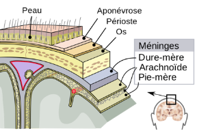 Qu'est ce que la migraine