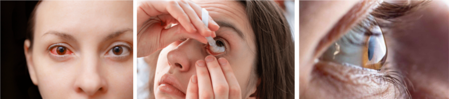douleurs yeux inflammation sécheresse
