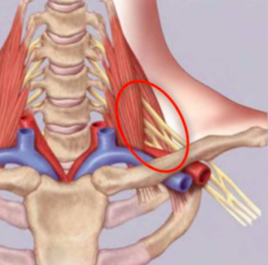 Le syndrome du défilé thoraco-brachial : ce qu'il faut savoir !