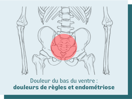 douleurs règles et endométriose