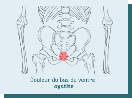 Les causes de douleur en bas du ventre