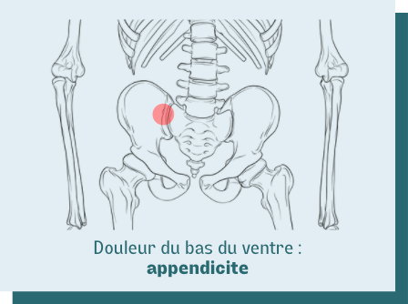 Les causes de douleur en bas du ventre