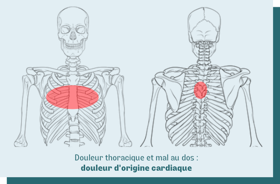 douleur cardiaque thorax dos