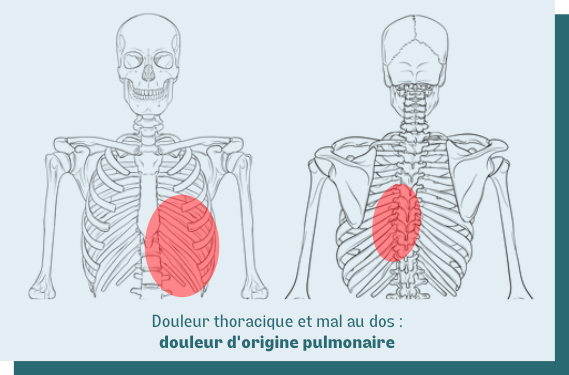 Mal au thorax et douleur au dos : quelles causes ?