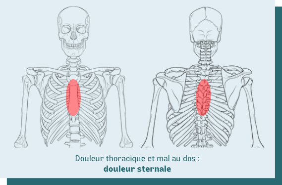 douleur sternum thorax dos