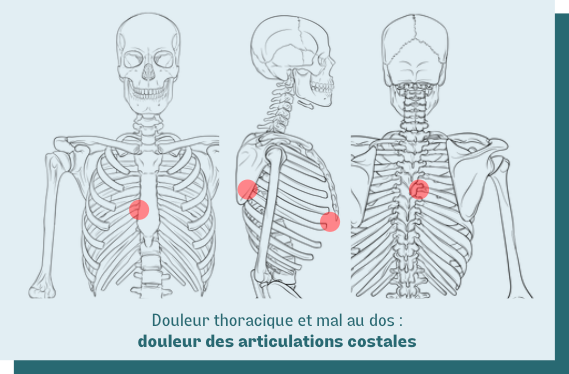 douleur costale thorax dos