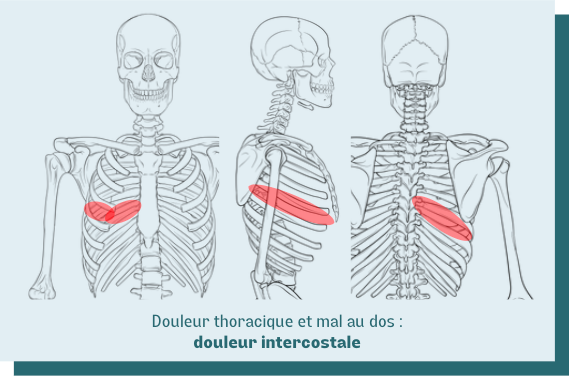 douleur intercostale thorax dos