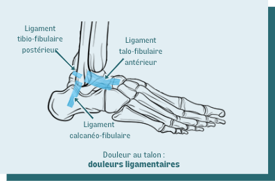 douleur ligament cheville