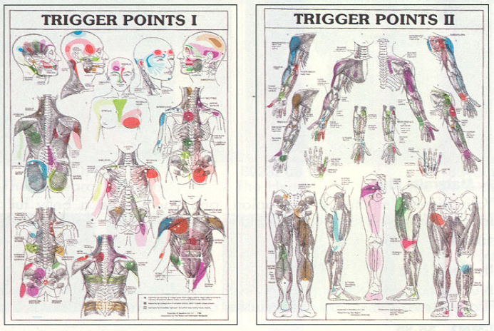 trigger-points