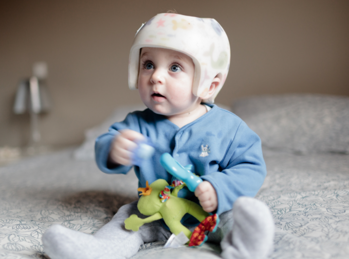 Bébé casque et plagiocéphalie