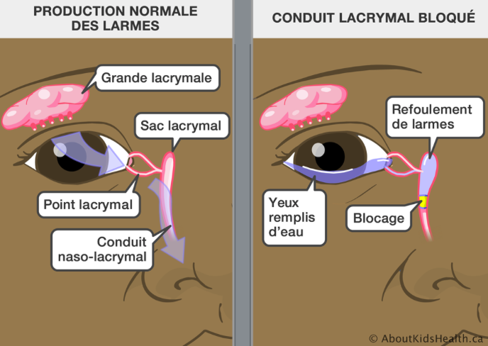 canal lacrymal traitement naturel