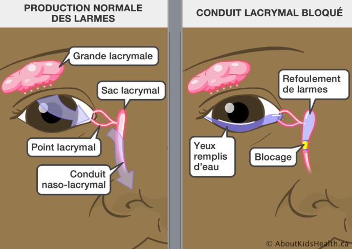 Bebe A Le Canal Lacrymal Bouche Guerir Ces Yeux Qui Pleurent Reflex Osteo