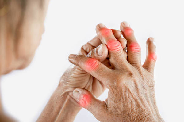 Arthrose des doigts : causes et traitements