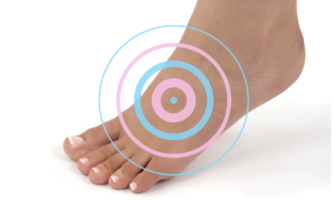 Douleur sur le dessus du pied : 10 causes et solutions